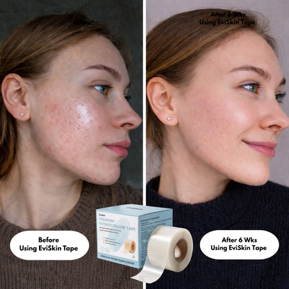Premium Hydrocolloid Roll That Heals & Protects Your Skin