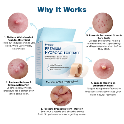 Premium Hydrocolloid Roll That Heals & Protects Your Skin