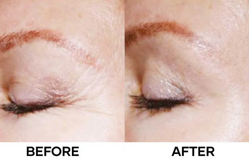 The 6 Peptide Skin Booster Serum