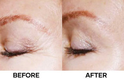 The 6 Peptide Skin Booster Serum