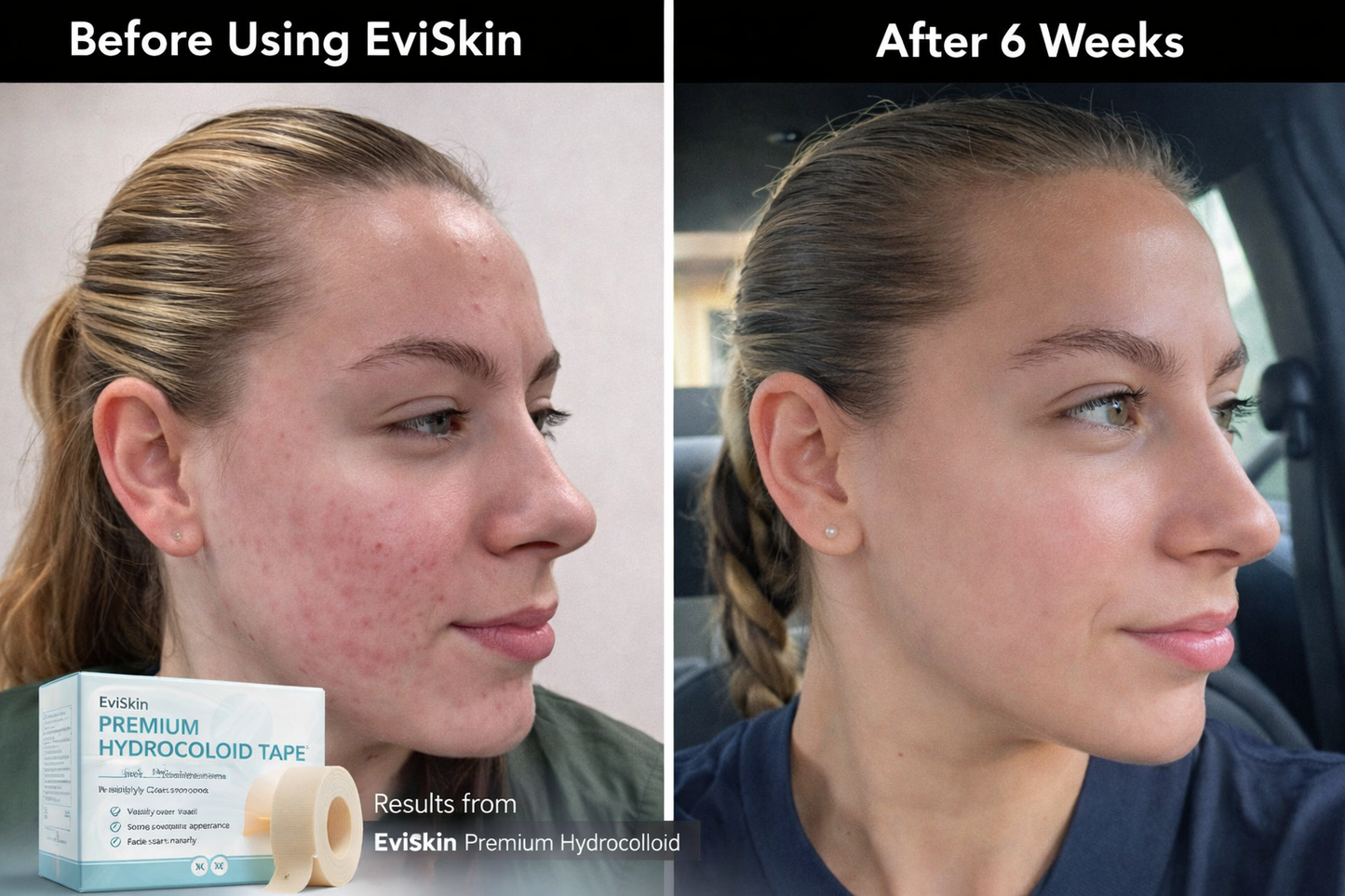 The Viral Hydrocolloid Tape That Heals & Protects Your Skin