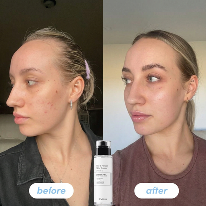 The 6 Peptide Skin Booster Serum