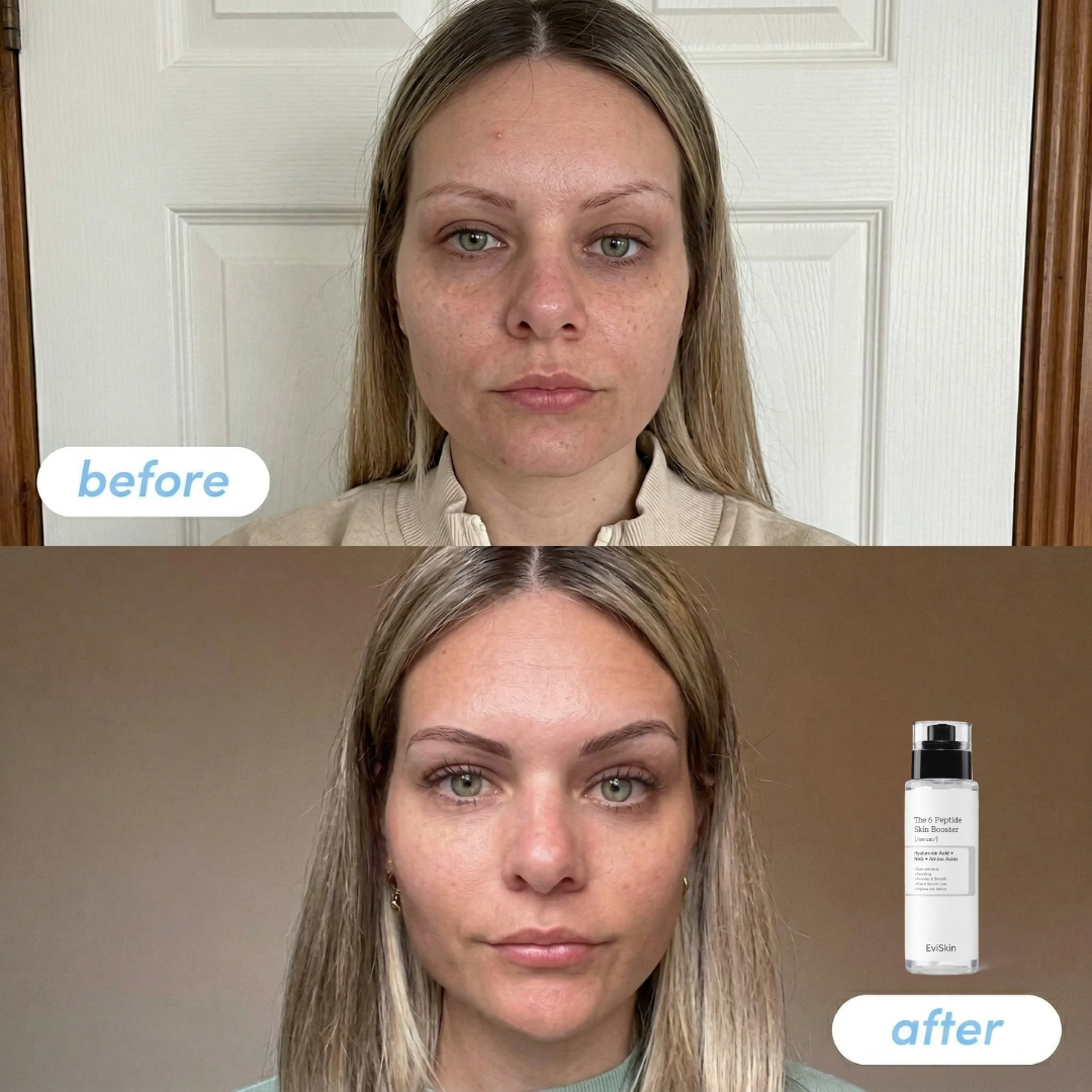 The 6 Peptide Skin Booster Serum
