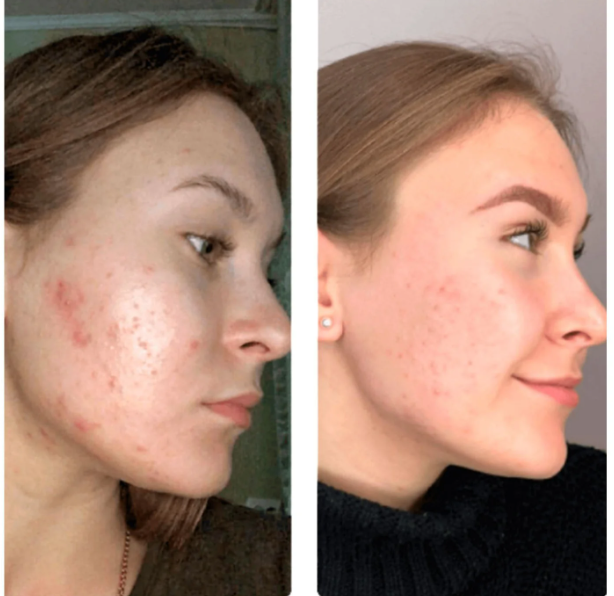 <em>Sophie M, Brighton, UK</em>